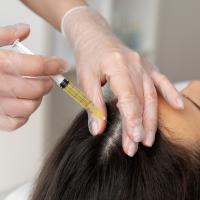 Уникальная процедура для здоровья и густоты волос – плазмолифтинг