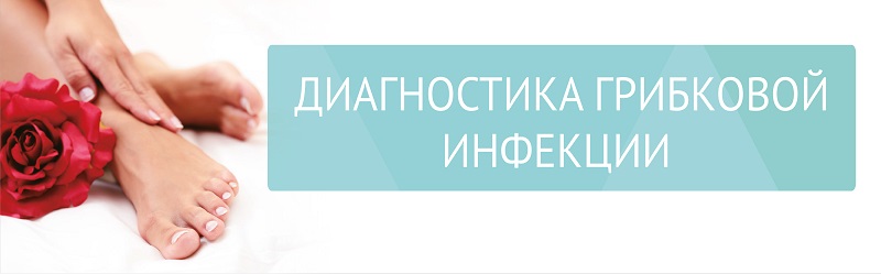 Диагностика грибковой инфекции от 250 р.