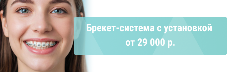 Антикризисные цены на брекеты – от 29 000р.