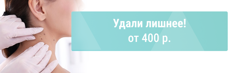 Пока солнце спит – удали лишнее!