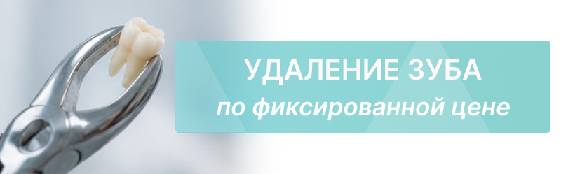 Удаление зубов по фиксированной цене