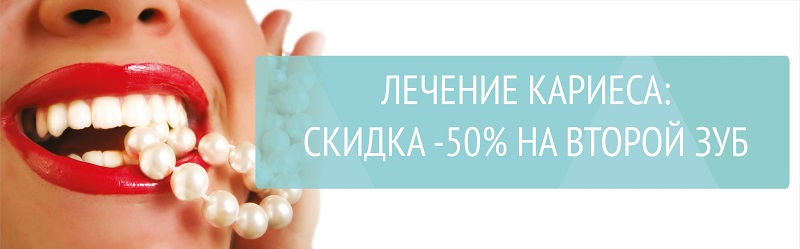 Скидка на лечение второго зуба -50%