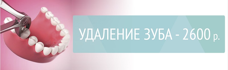 Удаление зуба - 2600 р.
